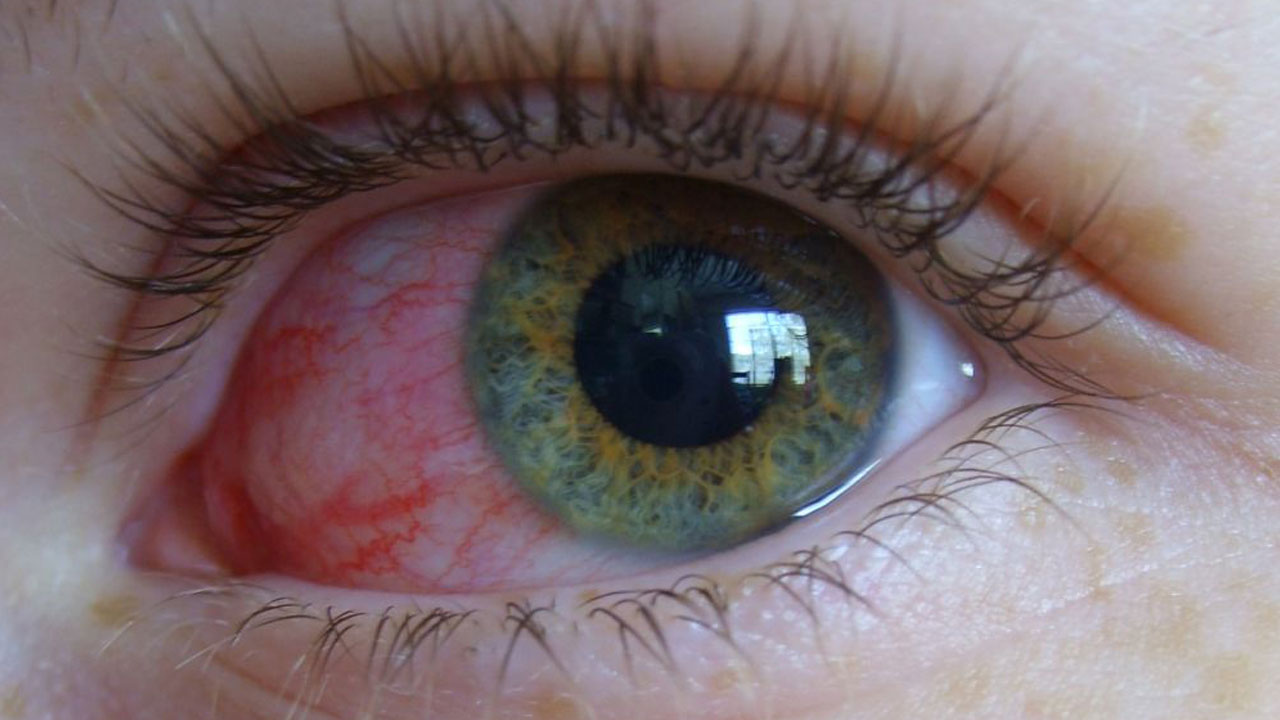 anterior-segment-surgery-treatments-in-pune