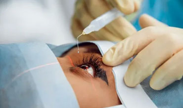 cataract-surgery-img